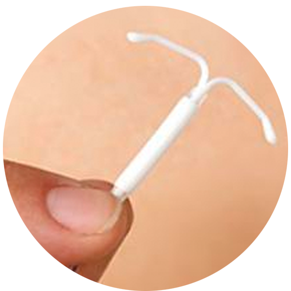 Photo of Mirena IUD