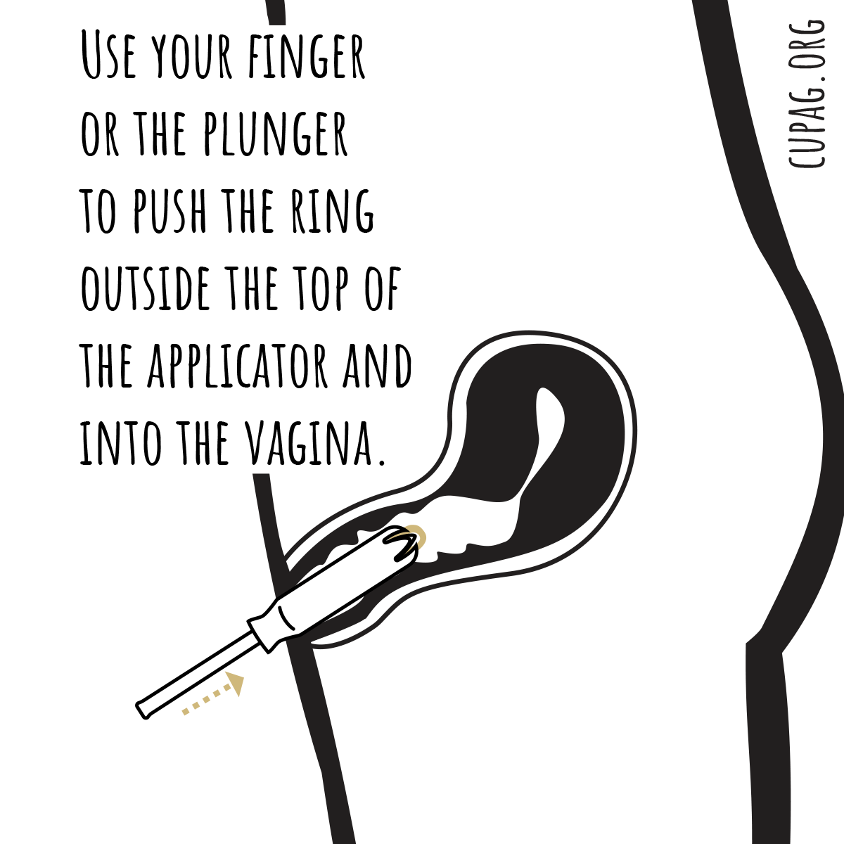 illustration showing how to push the ring into the vagina using the tampon applicator