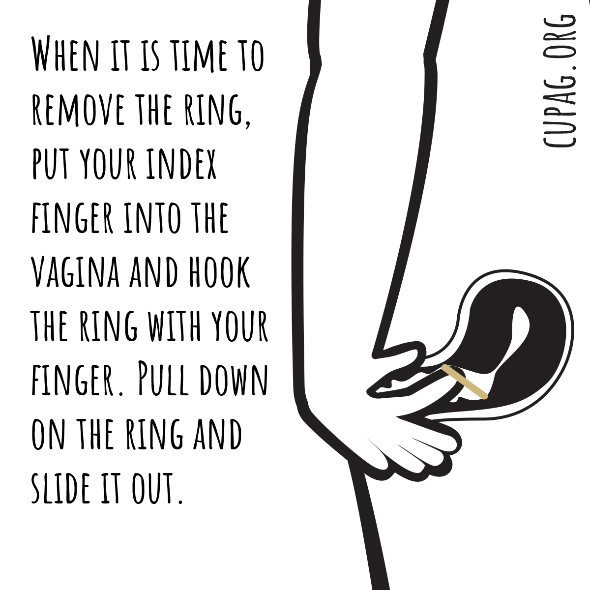 illustration showing a person inserting their finger into the vagina to remove the ring
