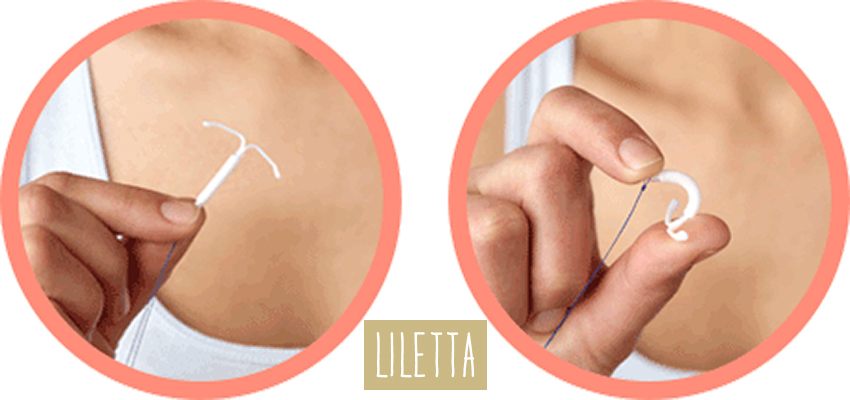 Image showing someone squeezing the Liletta IUD to show it's flexibility and size